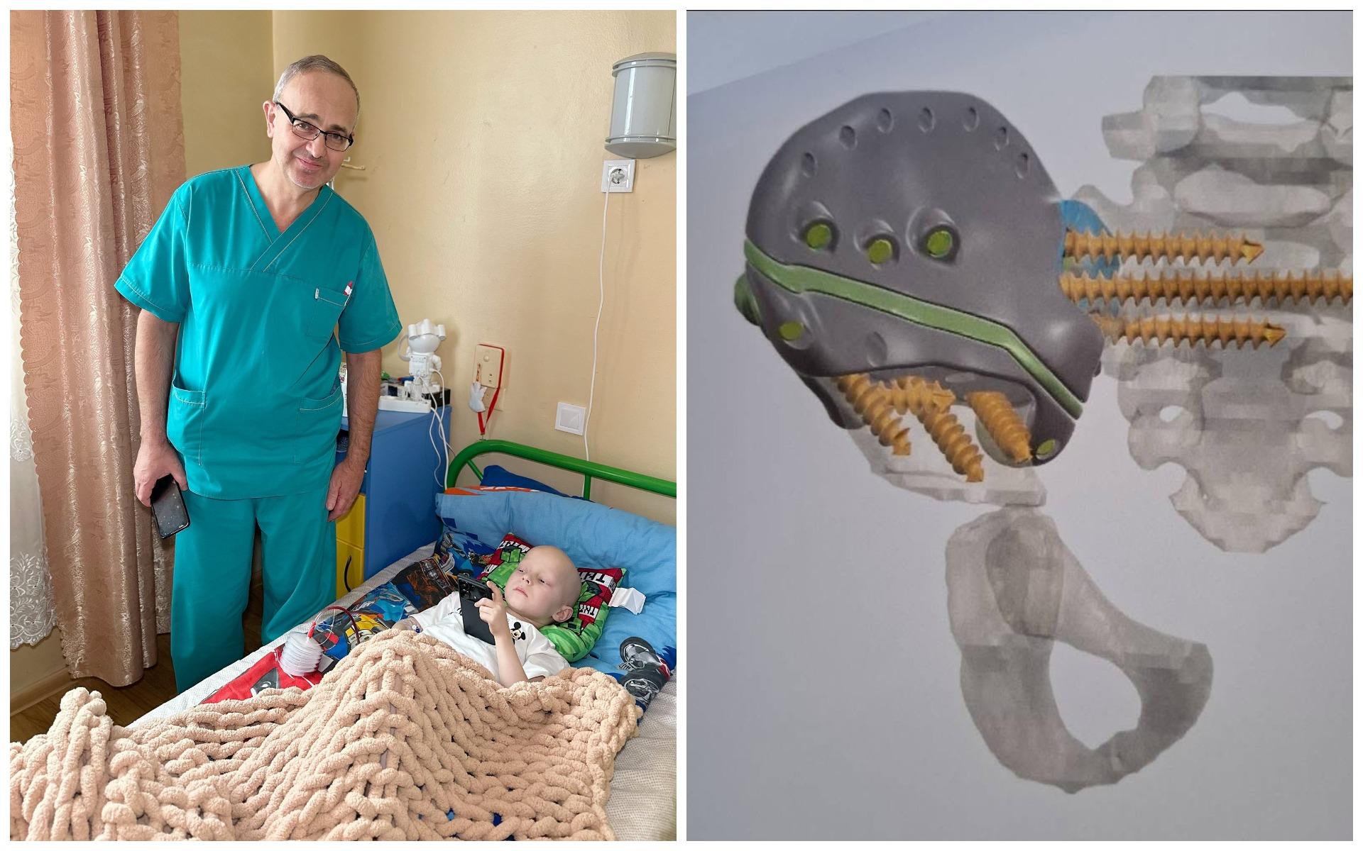 Вперше у світі у дитячому онкологічному відділенні Києва було використано подовжуючий протез таза