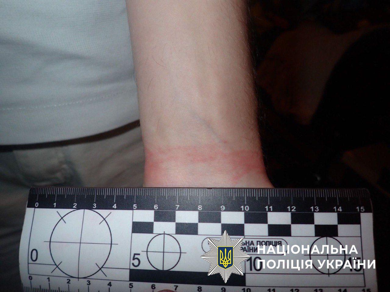 Жертва онлайн-знайомства: киянина побили і пограбували у власній квартирі