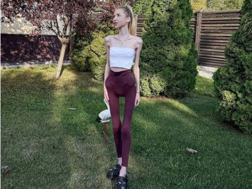 Мріє схуднути більше: українська модель Ліпницька важить 23 кілограми