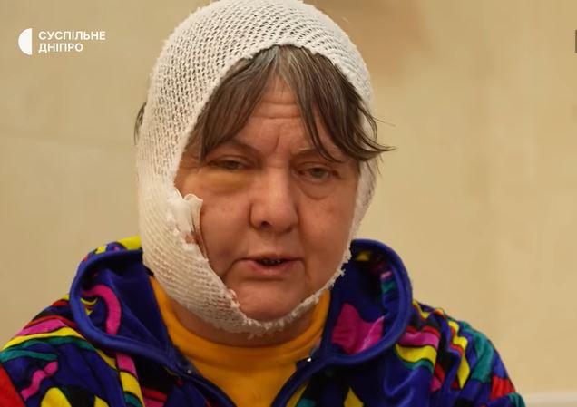 Росіяни розстріляли родину на Донеччині: лікарі рятують жінку, що вижила