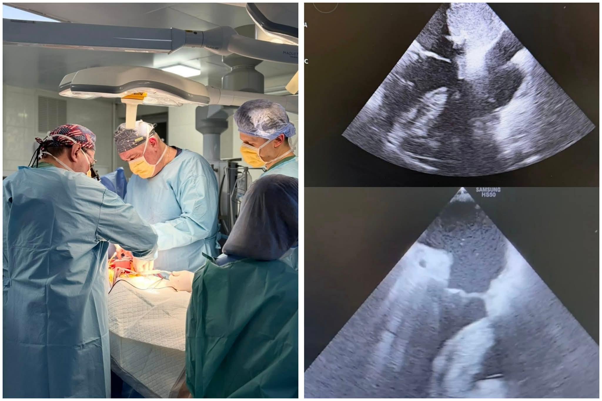 Врятували від смертельної загрози: вінницькі медики видалили пухлину з серця жінки