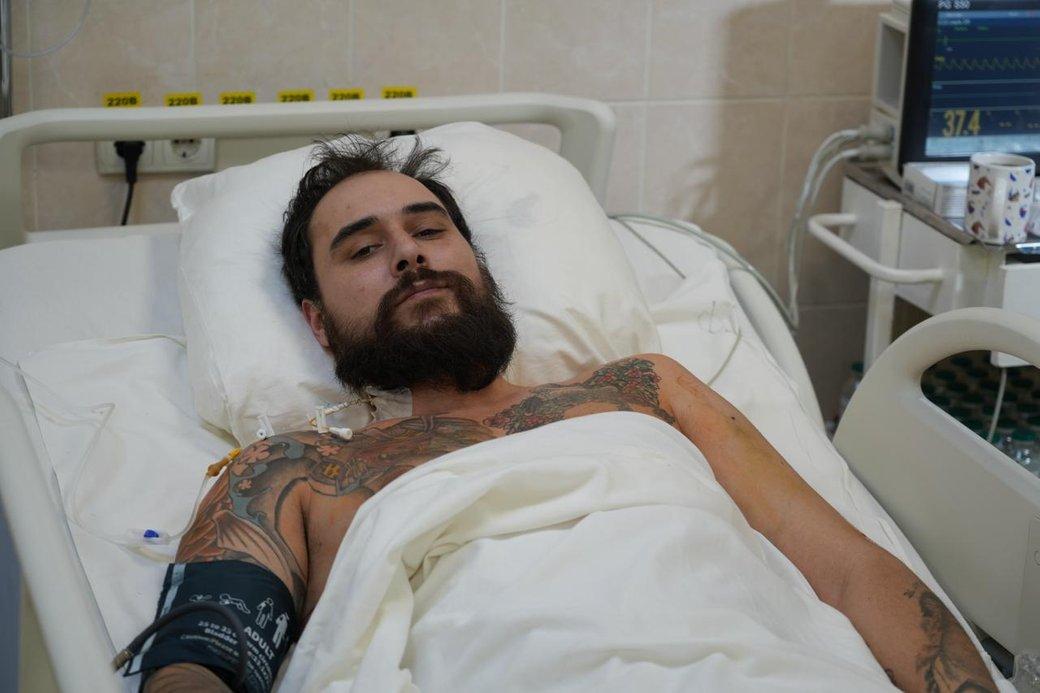 Шанс на мільйон: лікарі вилучили уламок з аорти військового, зупинивши його серце