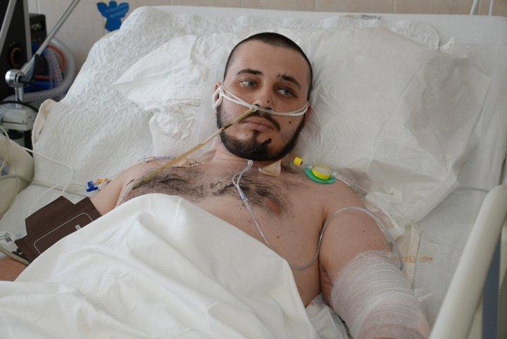 «20 годин чекав на порятунок під вогнем»: історія добровольця, який втратив ноги через атаку FPV-дронів